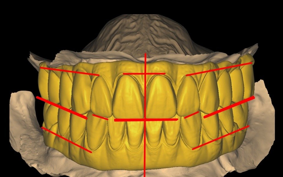 Occlusal plane and symmetry review