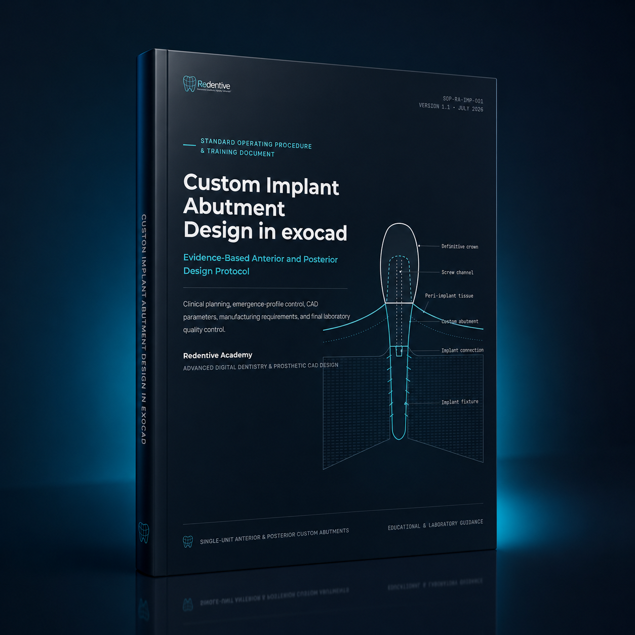 Custom Implant Abutment Design in exocad v1.1 - Image 3