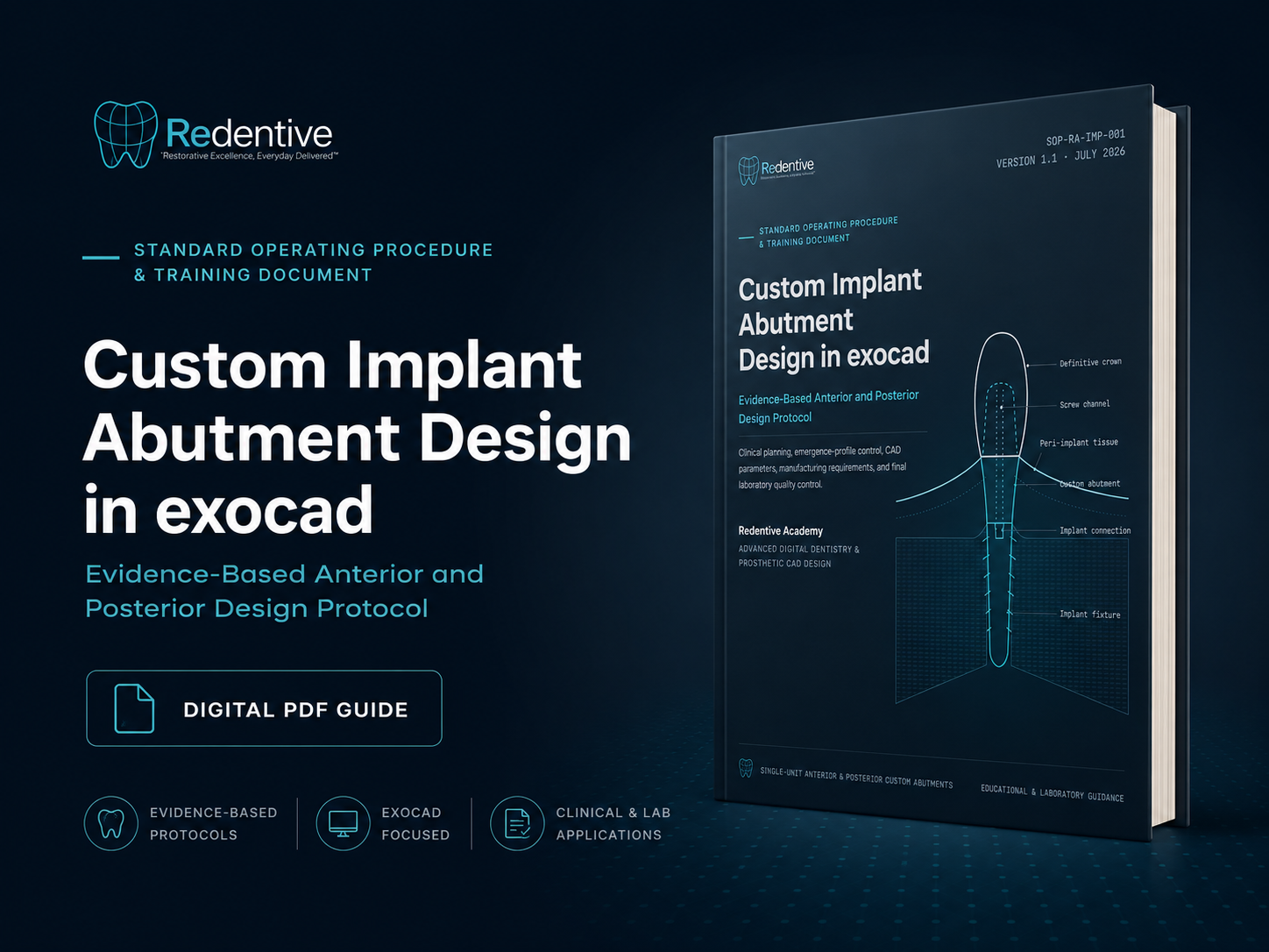 Custom Implant Abutment Design in exocad v1.1 - Image 2